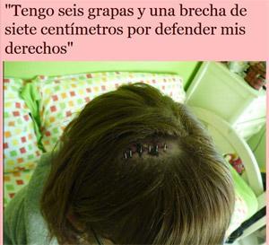 abrir entrevista estudiante agredida La Policía del PP detiene y apalea estudiantes menores de edad en la Comunidad Valenciana por protestar contra los recortes educativos