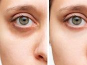 Truco viral para disimular ojeras