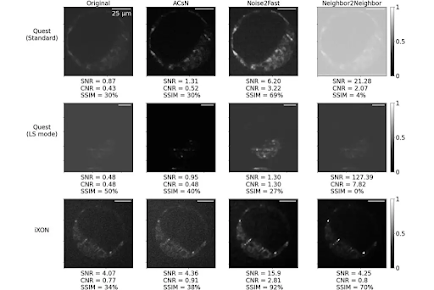 Científicos usan física cuántica y cámaras ultrasensibles para observar embriones vivos sin dañarlos Científicos usan física cuántica y cámaras ultrasensibles para observar embriones vivos sin dañarlos