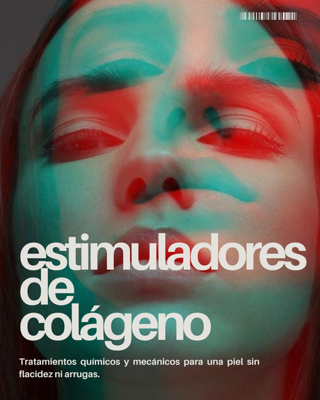 Bioestimuladores de colágeno facial Radiesse Bioestimuladores de colágeno Bioestimulación radiesse hifu marcas faciales radiesse sculptra radiofrecuencia pixelada micro Argentina inyectable antes y después precio