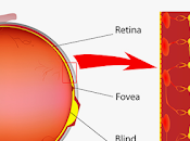 células retinales transforman retinosis pigmentaria.