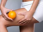 Celulitis: afecta como tratarla