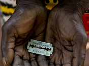 mutilación genital femenina.