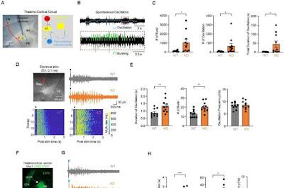 Revierten los síntomas del autismo con fármaco experimental Revierten los síntomas del autismo con fármaco experimental