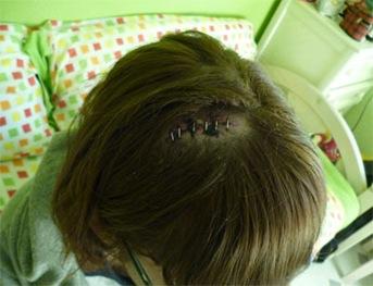 Estudiante herida Valencia