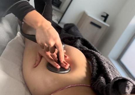 ¿Qué es la radiofrecuencia corporal y cómo funciona?