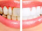 importancia salud bucodental