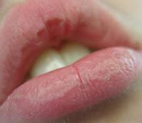 Tips para cuidar tus labios