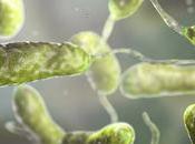 ¿Cuáles síntomas bacteria come carne?