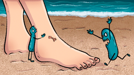 ¿Cuáles son los síntomas de la bacteria come carne?