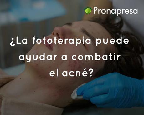 ¿La fototerapia puede ayudar a combatir el acné?