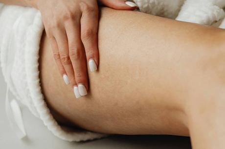 La insuficiencia venosa crónica afecta a millones de españoles y gana visibilidad