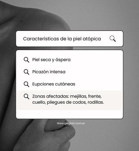 Dermatitis atópica características Dermatitis atópica que es por que aparece como se cura trata productos