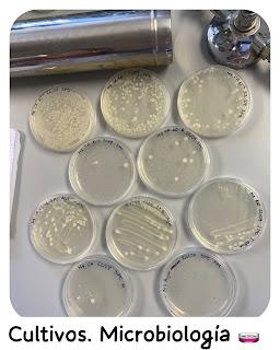 Cultivos MicrobiologĂ­a