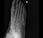 Fractura metáfisis proximal quinto metatarsiano, datos pseudoartrosis,