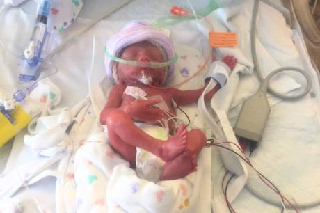 El viaje invisible de los bebés prematuros y sus familias, apoyado por Pequeños Grandes Héroes El viaje invisible de los bebés prematuros y sus familias, apoyado por Pequeños Grandes Héroes