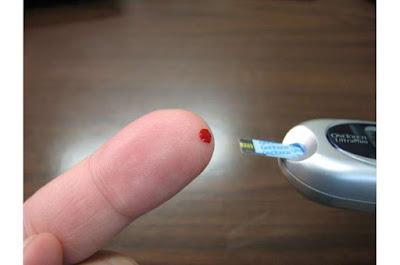 Atención de la hiperglucemia inducida por esteroides