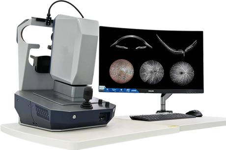 GX2 afianza su compromiso con la salud visual mediante equipos OCT de última generación GX2 afianza su compromiso con la salud visual mediante equipos OCT de última generación