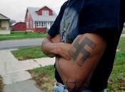 Cirujano rechaza operar paciente tener tatuaje nazi brazo