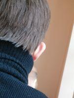 Enfermedades de los Genitales Masculinos infertilidad masculina