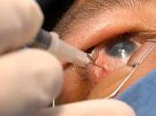 Glaucoma, enfermedad irreversible afecta personas mayores años