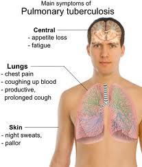  Tuberculosis, sus síntomas