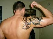 Quitar tatuajes Madrid