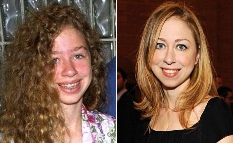 El gran cambio de Chelsea Clinton
