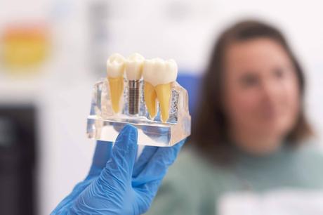 CML Odontólogos consolida en A Coruña el éxito de los implantes dentales de carga inmediata CML Odontólogos consolida en A Coruña el éxito de los implantes dentales de carga inmediata