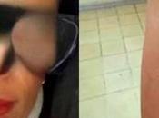 Enfermera IMSS denuncia agresión física parte doctora consultorio Villa Reyes