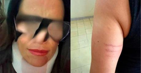 Enfermera del IMSS denuncia agresión física por parte de una doctora en consultorio de la CFE en Villa de Reyes