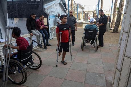 Las autoridades de Gaza cifran en 6.000 los amputados, de los que una cuarta parte son niños