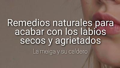 Remedios naturales para acabar con los labios secos y agrietados