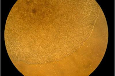 Prueban nuevos enfoques para tratar las enfermedades autoinmunes. Prueban nuevos enfoques para tratar las enfermedades autoinmunes.