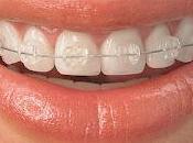 ¡Adiós Dolor! Trucos Infalibles para Calmar Molestias Brackets