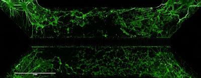 Las células madre pueden regenerar el tejido cerebral después de un ACV Las células madre pueden regenerar el tejido cerebral después de un ACV