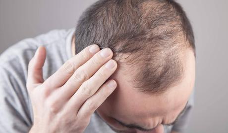 Xpecia Hombre, el suplemento que frena la caída del cabello y refuerza su crecimiento desde el interior Xpecia Hombre, el suplemento que frena la caída del cabello y refuerza su crecimiento desde el interior