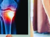 Caminar, pedalear nadar, mejor ejercicio para artrosis rodilla, según estudio