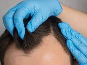 Clínica Capilar Mora ofrece últimas plazas para trasplante capilar enfoque médico resultado natural