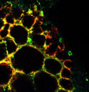 Hallan molècula que podrìa acelerar el reciclamiento celular