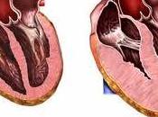 Posible responsable cardiomiopatía