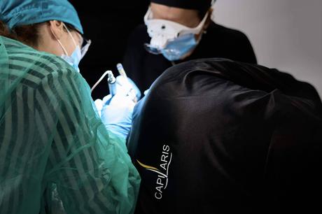 Capilaris Marbella impulsa el injerto capilar FUE Zafiro sin rapar, con resultados naturales Capilaris Marbella impulsa el injerto capilar FUE Zafiro sin rapar, con resultados naturales