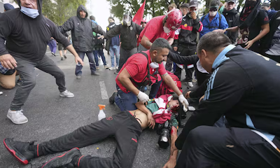 Derechos humanos: el laboratorio del doctor Milei