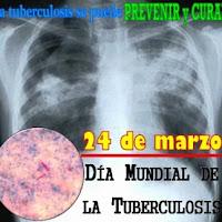 Terminar con la Tuberculosis en Nuestra Generación