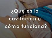 ¿Qué cavitación cómo funciona?